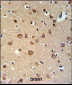 PDE6C Antibody (Center)
